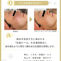 画像329