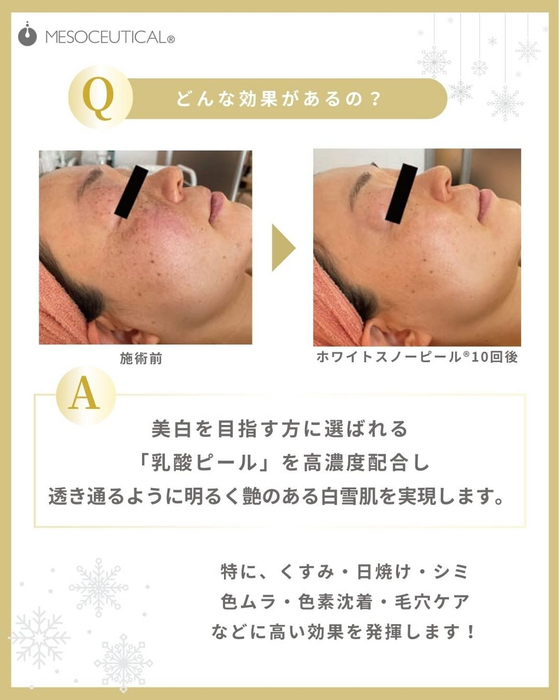 画像329