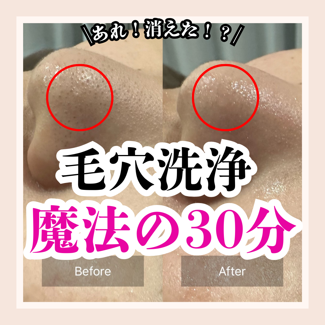 安心のカウンセリングであなたの肌を理解