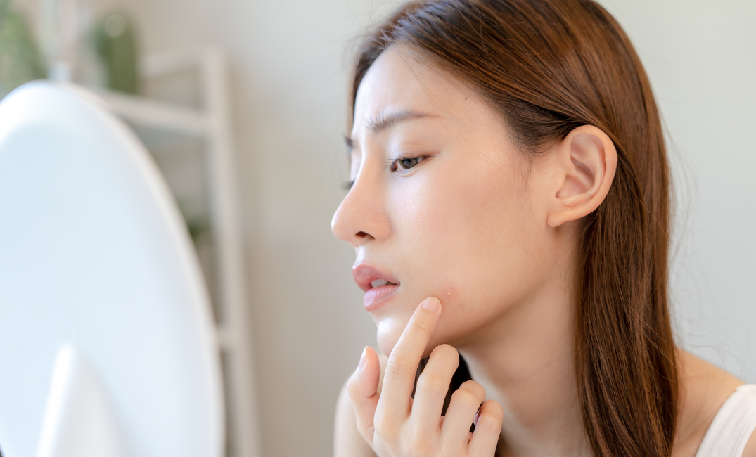黒ずみによる悩みを解消！毛穴洗浄の革命的アプローチ