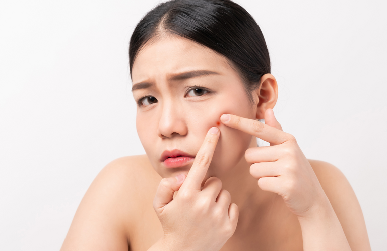 毛穴開きや黒ずみが気になる方必見！梅田で人気の毛穴洗浄サロン！